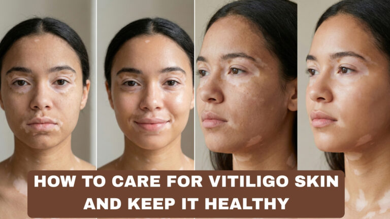 How to Care for Vitiligo Skin and Keep It Healthy