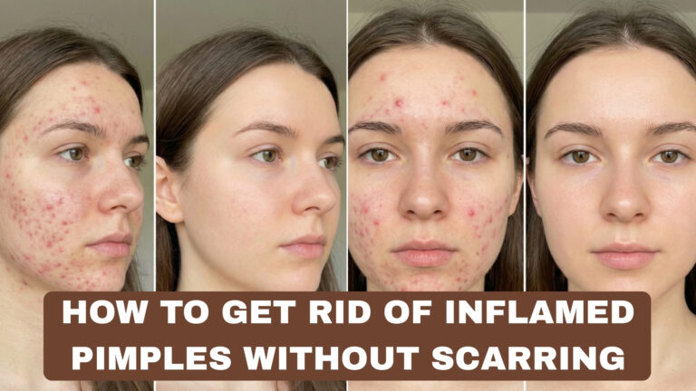 How to Get Rid of Inflamed Pimples Without Scarring