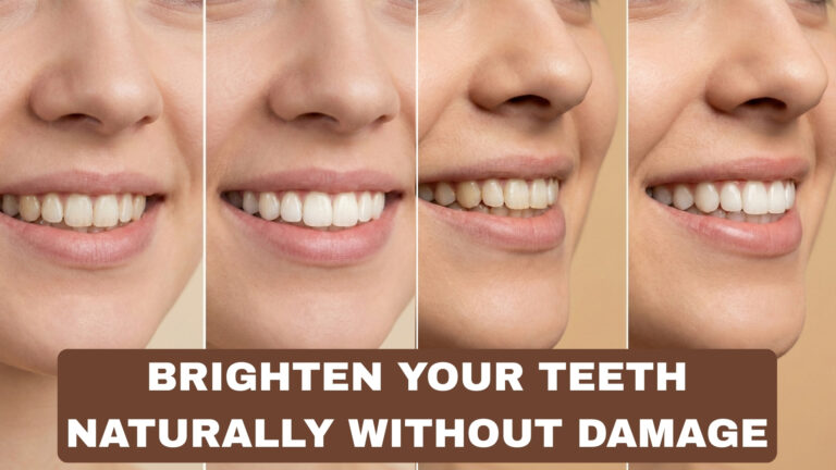 How to Brighten Your Teeth Naturally Without Damage
