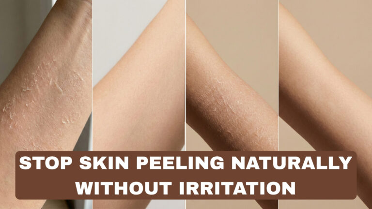 How to Stop Skin Peeling Naturally Without Irritation