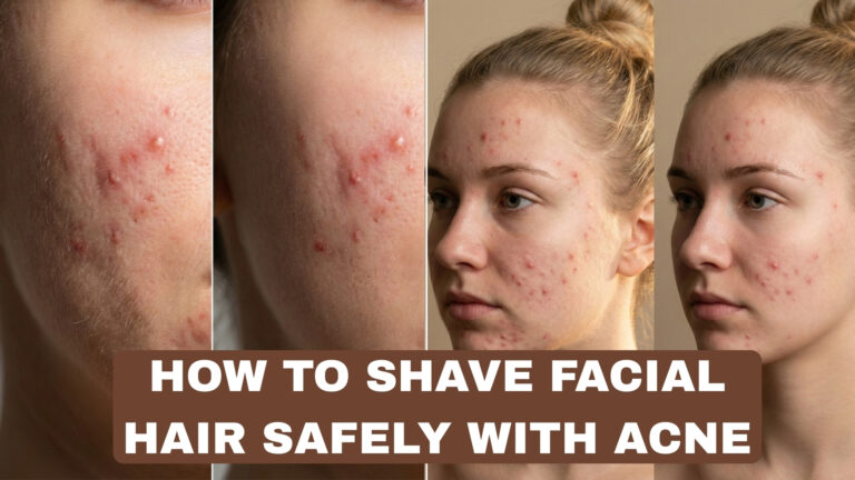 How to Shave Facial Hair Safely With Acne